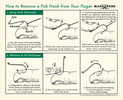 remove, hook, how to