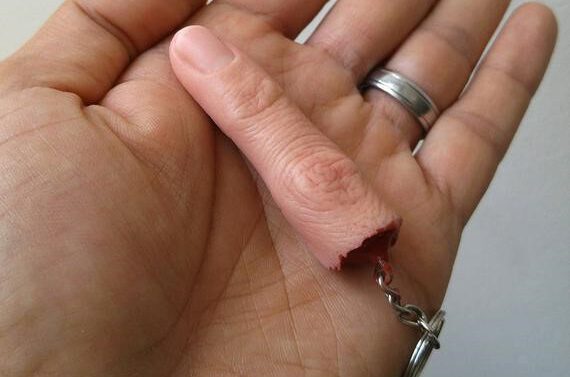 Dedo humano encontrado en el interior de un pez